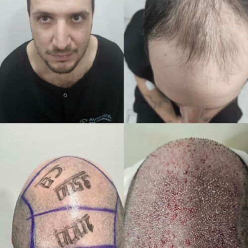 836dddb7-b0d6-45f1-8222-07fdae0b4135