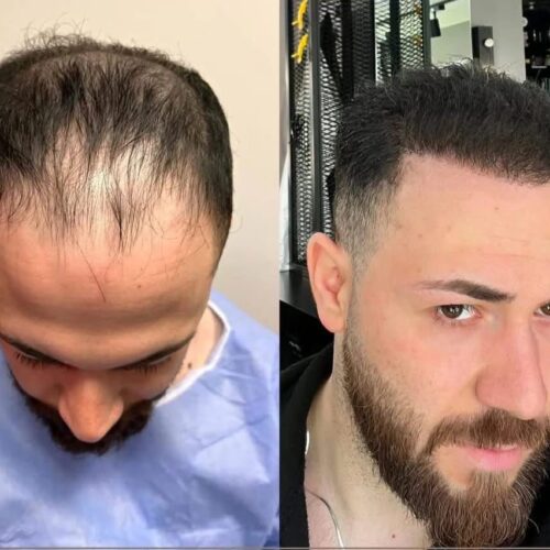 b3602add-4cb9-4b01-9d10-a153b6fb6d31