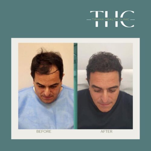 b7312cdf-302c-4f26-9673-6bb6b95999df