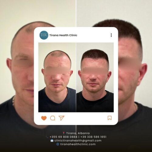 WhatsApp Image 2026-02-13 at 3.00.56 PM